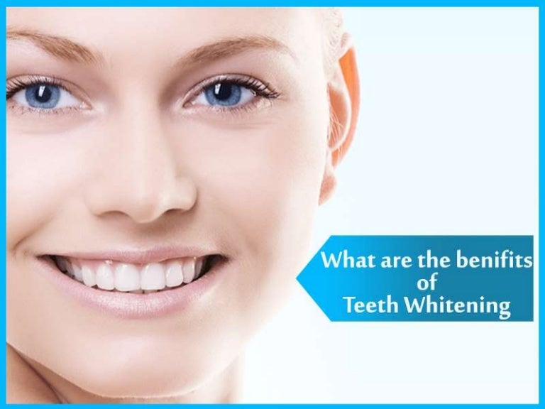 Some Benefits of Teeth Whitening