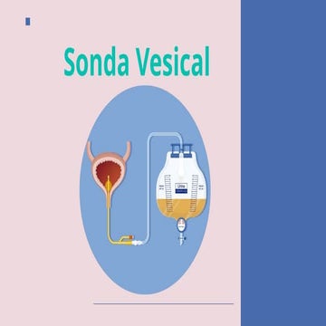 CATETERISMO VESICAL PEDIÁTRICO | PPTX