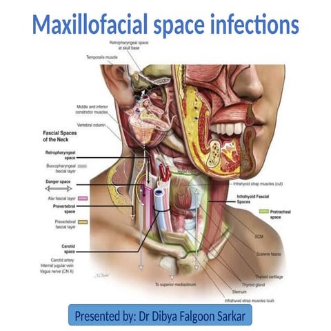 space infections OMFS -200717163419.pptx