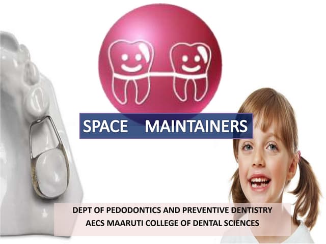Space maintainers 