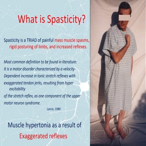 Spasticity in Rehabilitation