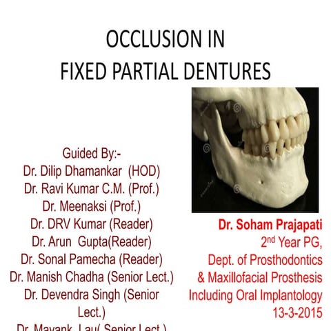 Occlusion In Fixed Partial Denture