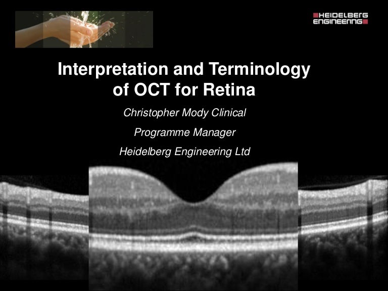 Spectralis oct normal anatomy & systematic interpretation.