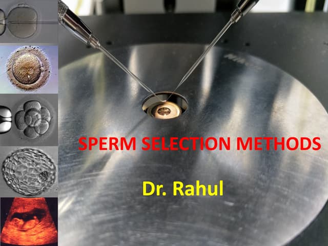 SPERM SELECTION IN ICSI