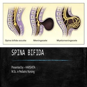 Spina bifida