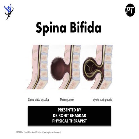 Spina Bifida - Dr Rohit Bhaskar