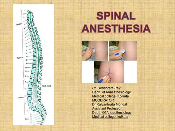 Spinal_Anaesthesia_Presentation and types | PPT