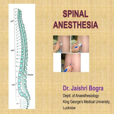 Spinal_Anaesthesia.pptx
