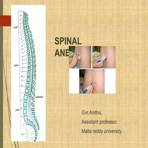Spinal_Anaesthesia.in complified manner.