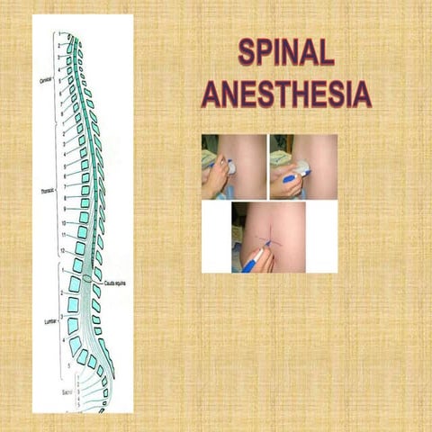 Spinal anaesthesia tushar.pptx