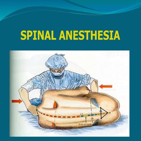 Spinal anesthesia
