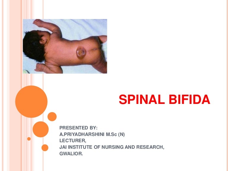 Spinal bifida