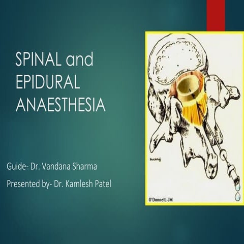 combined Spinal Epidural anaesthesia ppt