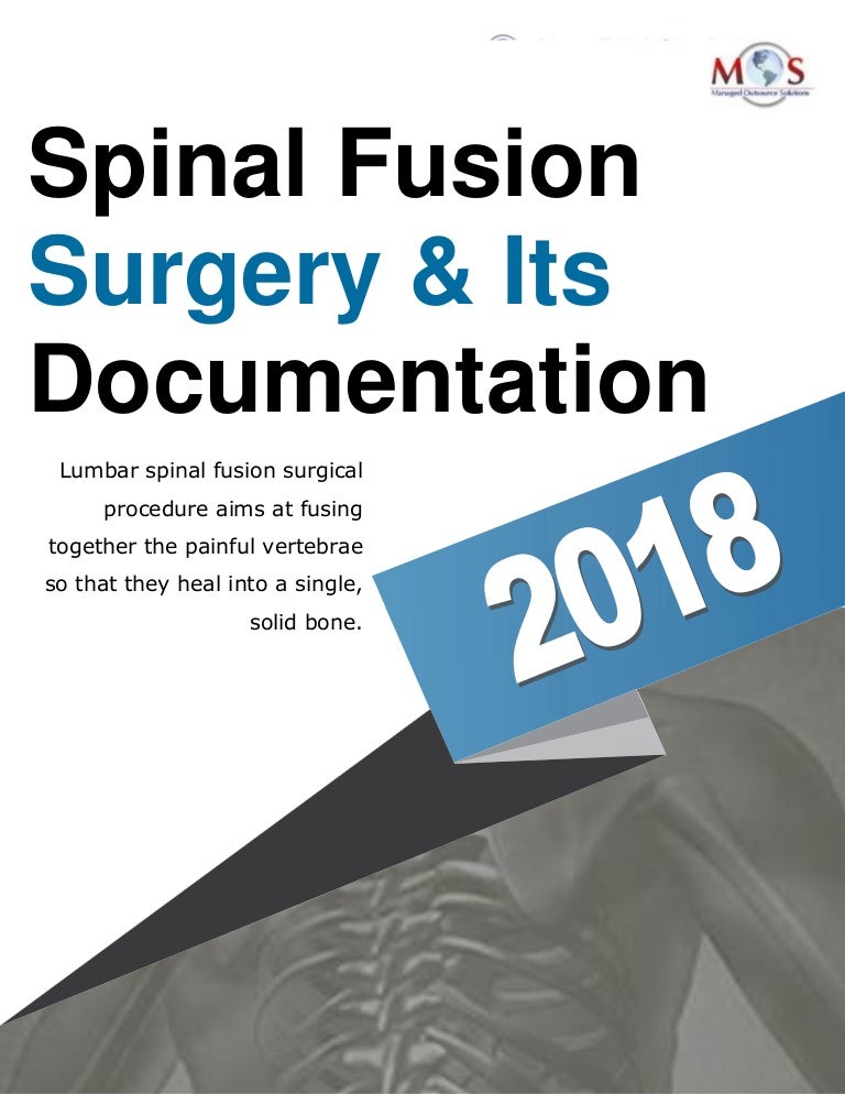 Spinal Fusion Surgery & Its Documentation