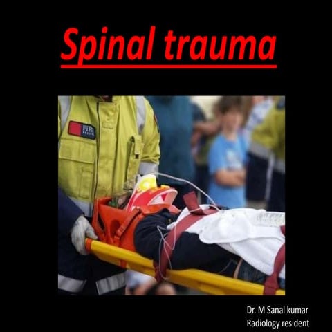 Spinal trauma  IMAGING