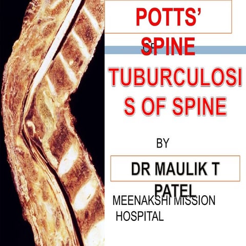 Spine presentation