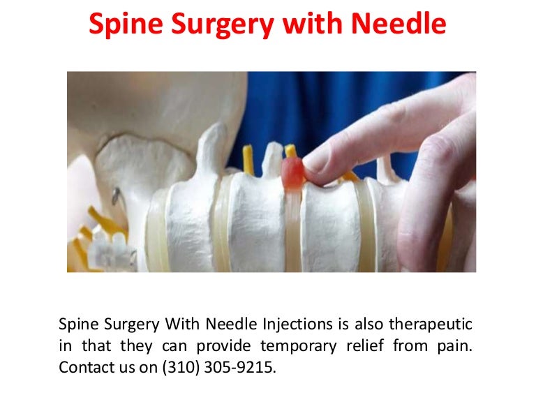 Laser Spine Surgery California