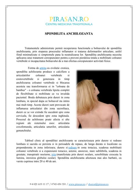 acupunctura spondilita anchilozanta)