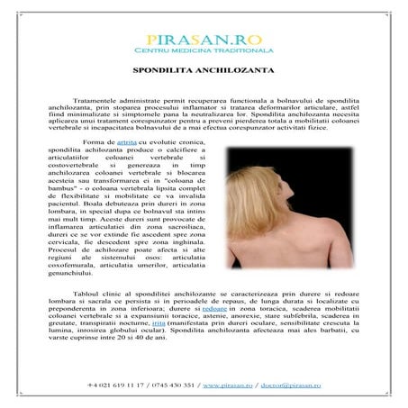 Spondilita anchilozanta