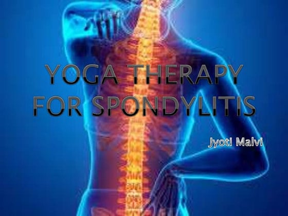 spondylitis-190915125203-thumbnail.jpg?width=560&fit=bounds
