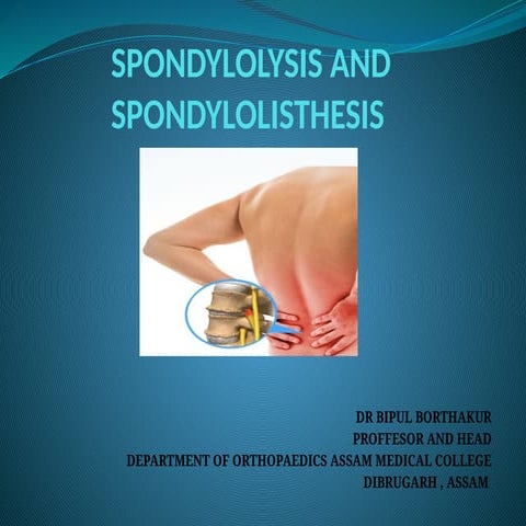 SPONDYLOLYSIS AND SPONDYLOLISTHESIS .pptx