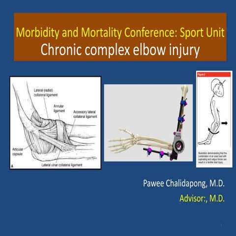 [Sport] mm chronic elbow injury