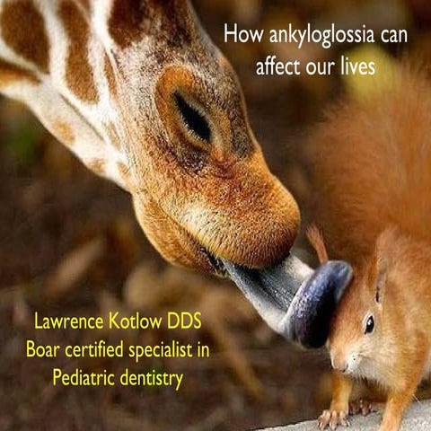 Ankyloglossia a congenital oral anomaly | PPT
