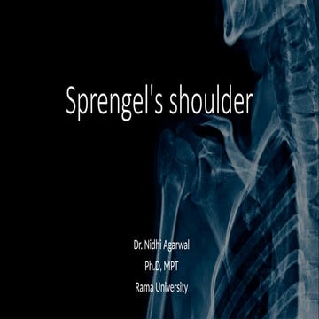 SPRENGEL SHOULDER.pptx