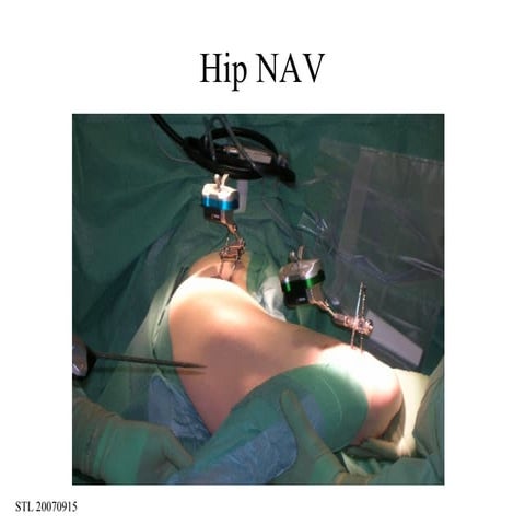 SøRen Toksvig Larsen. The Role Of Cas (Computer Assisted Surgery). Slide 40 44