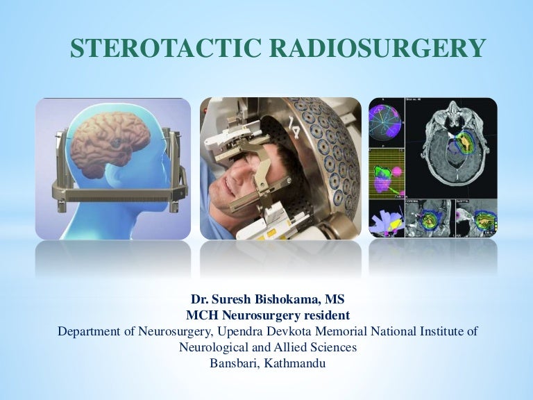 Stereotactic Radiosurgery (SRS)