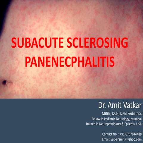 SSPE, dr. amit vatkar, pediatric neurologist