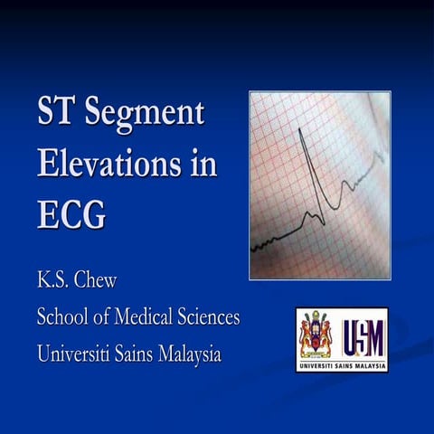 st-segment-elevations-in-ecg2-1193560461813561-5.ppt