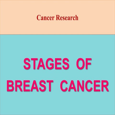 Stages of Breast Cancer | PPTX