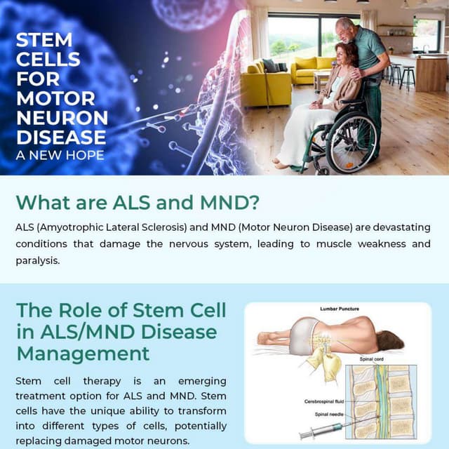 Stem cell for motor neuron disease - Advancells