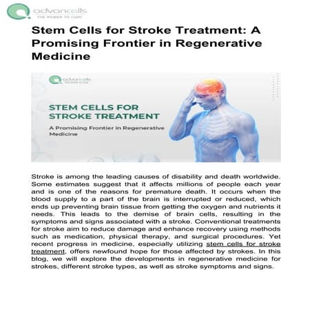 Stem Cells for Stroke Treatment: A Promising Frontier in Regenerative ...