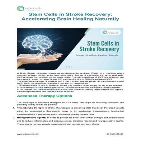 Stem Cells in Stroke Recovery: Accelerating Brain Healing Naturally