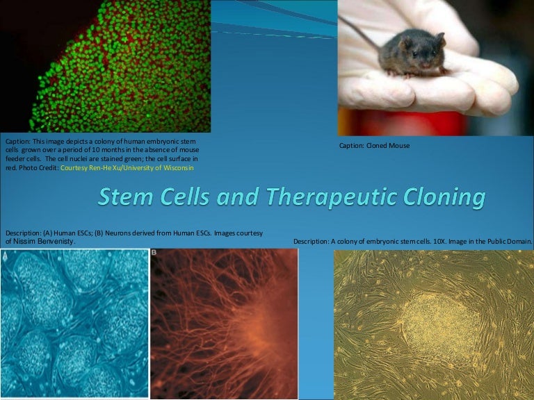 Stem cell & therapeutic cloning Lecture