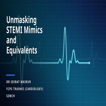 STEMI vs STEMI Mimics vs STEMI Equivalent.pptx