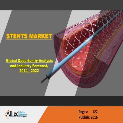 Stent Market Size & Share | Industry Forecast 2022