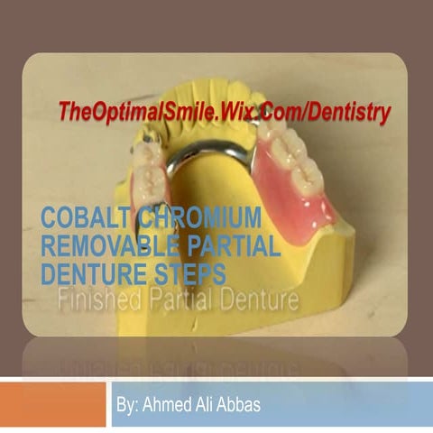 Removeable Partial Denture Steps cobalt chromium