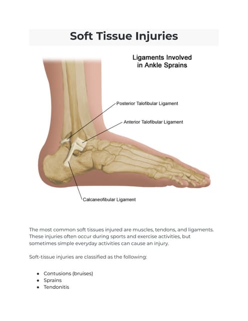 Understanding and Managing Soft Tissue Injuries Effectively | PPTX