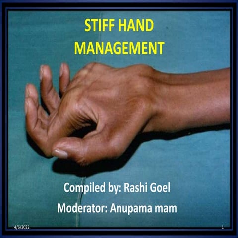 Stiff Hand Dr. Rashi Goel (PT)