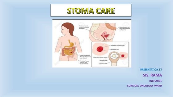Colostomy care : Nursing management | PDF