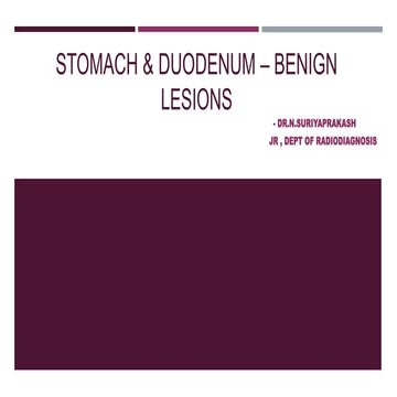 Stomach and duodenum_-_benign_lesions[2]