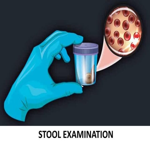 Concentration Techniques for stool examination .pptx