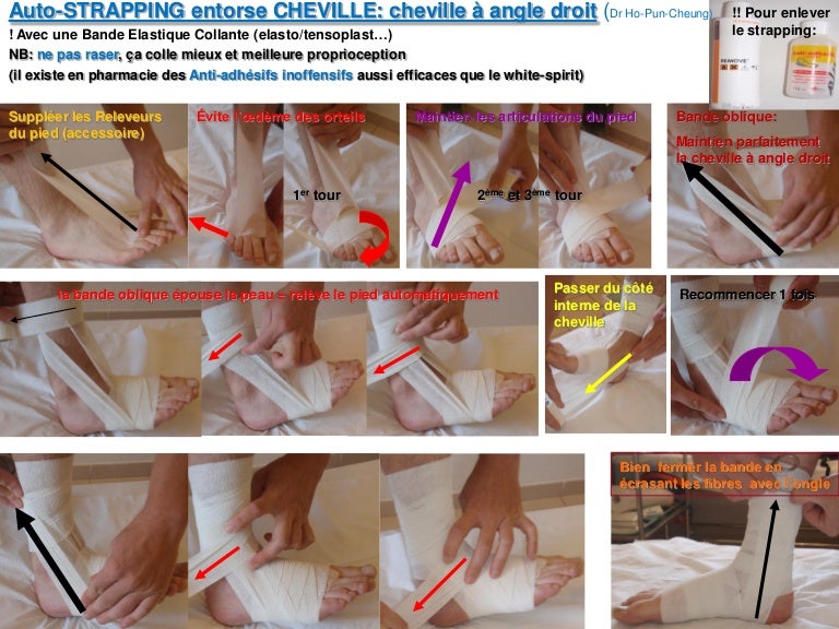 Entorse Laterale Cheville Contention Souple Strapping Rapide Effica
