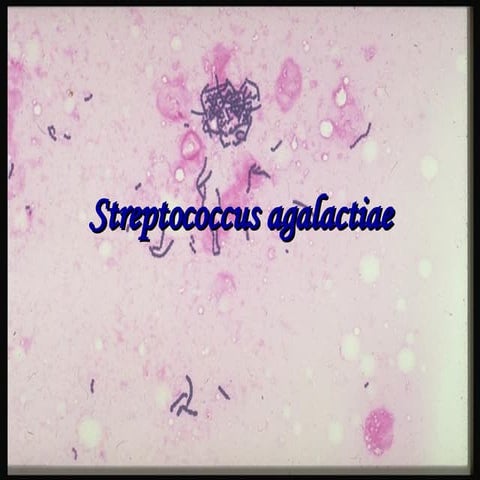 Streptococcus Agalactiae