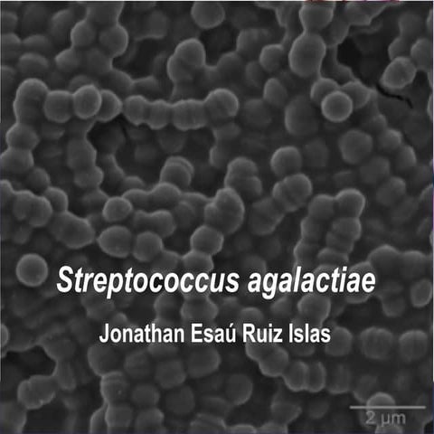 Streptococcus Agalactiae