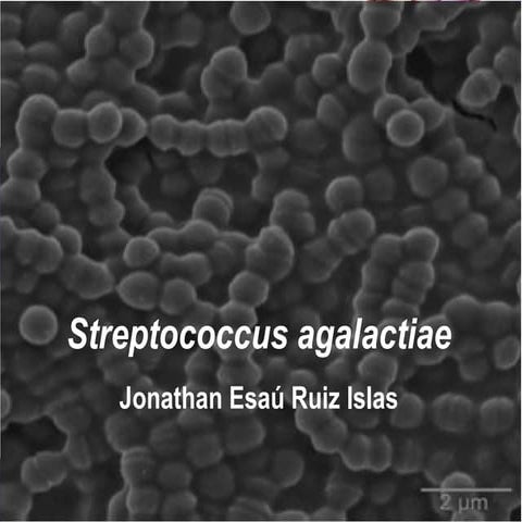 Streptococcus agalactiae