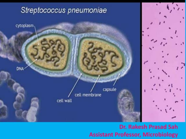 Streptococcus pneumoniae by Dr. Rakesh Prasad Sah